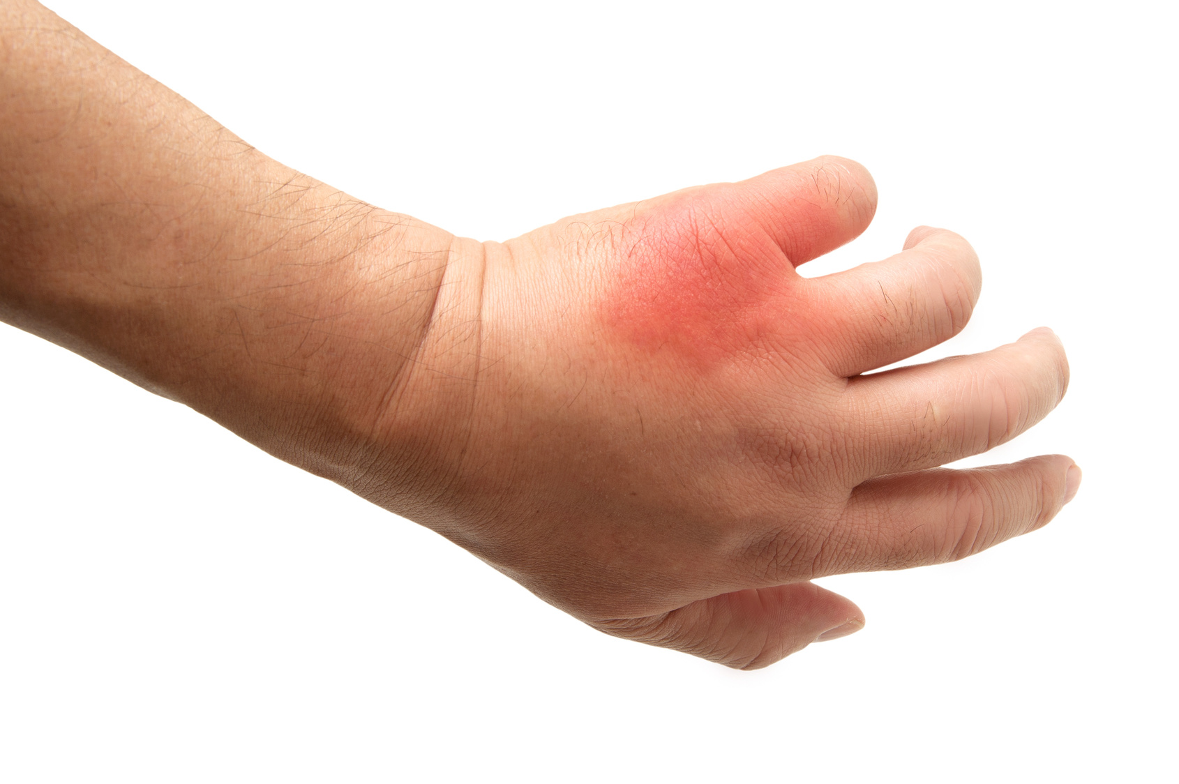 どのような傷に適している?